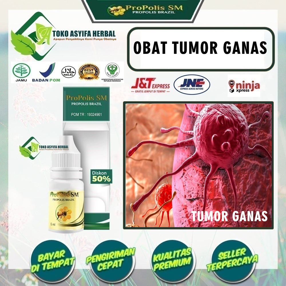 Obat Tumor Ganas, Obat Tumor, Penghilang - Penumpas Tumor Ganas Di Leher, Otak, Hati, Hidung, Perut