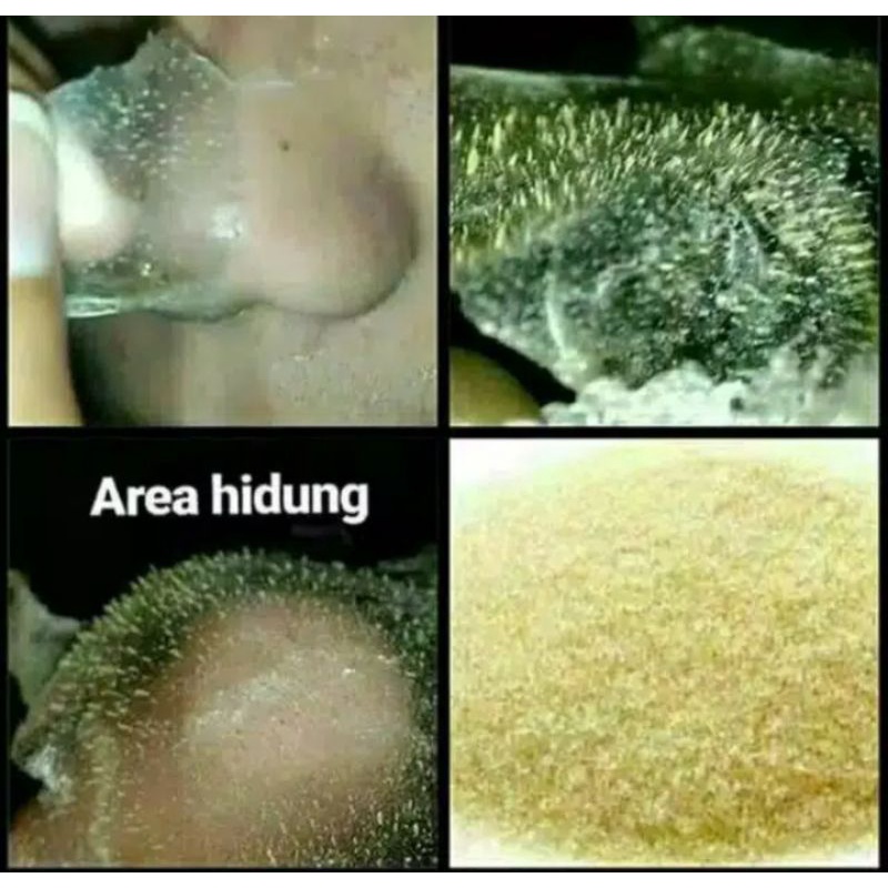 GELATIN ORIGINAL 3 gr ANGKAT KOMEDO TUNTAS