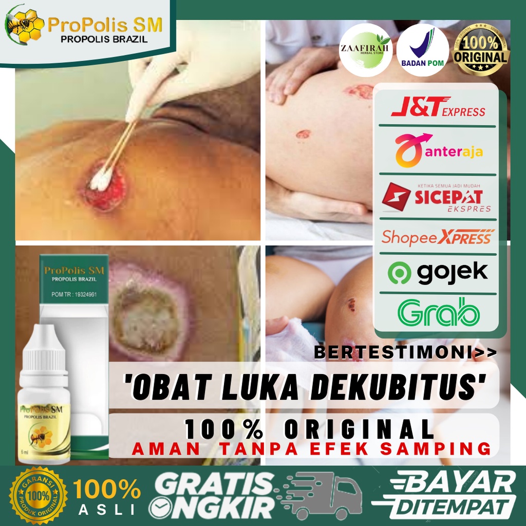 Obat Luka Dekubitus Ulkus Dekubitus Luka Tekanan Di Pantat Bokong Penumbuh Jaringan Luka Dekubitus L