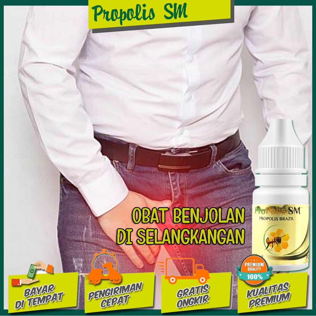 Obat Herbal Benjolan di Selangkangan / Benjolan di Area Intim Kelamin Pria Atau Wanita Propolis SM