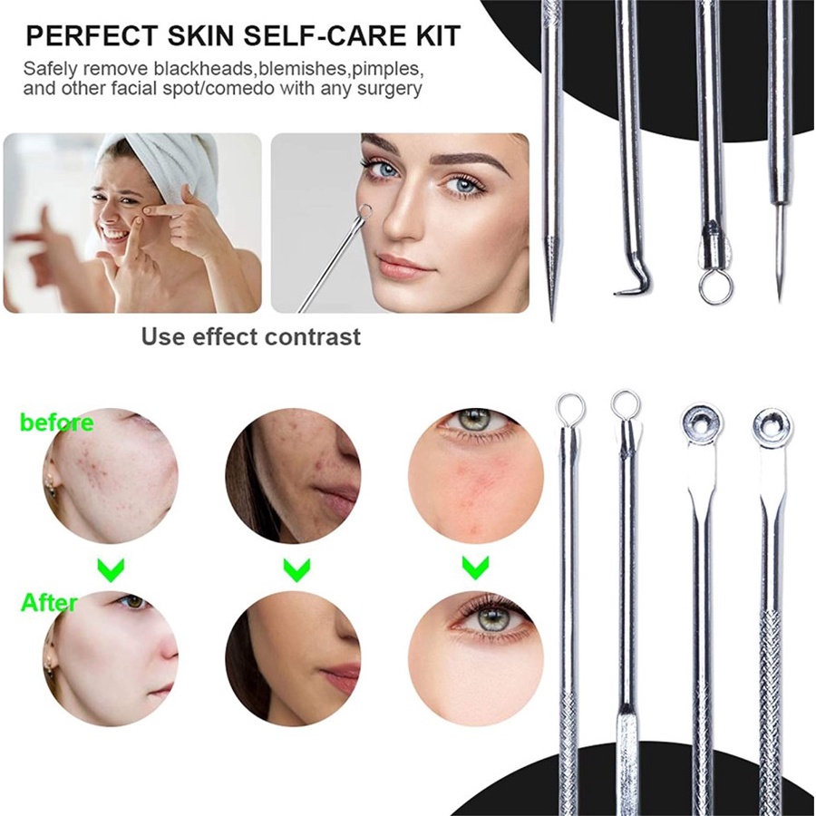 Alat Pinset Facial Pencetan Jerawat Komedo Acne Removal Remover 4Pcs