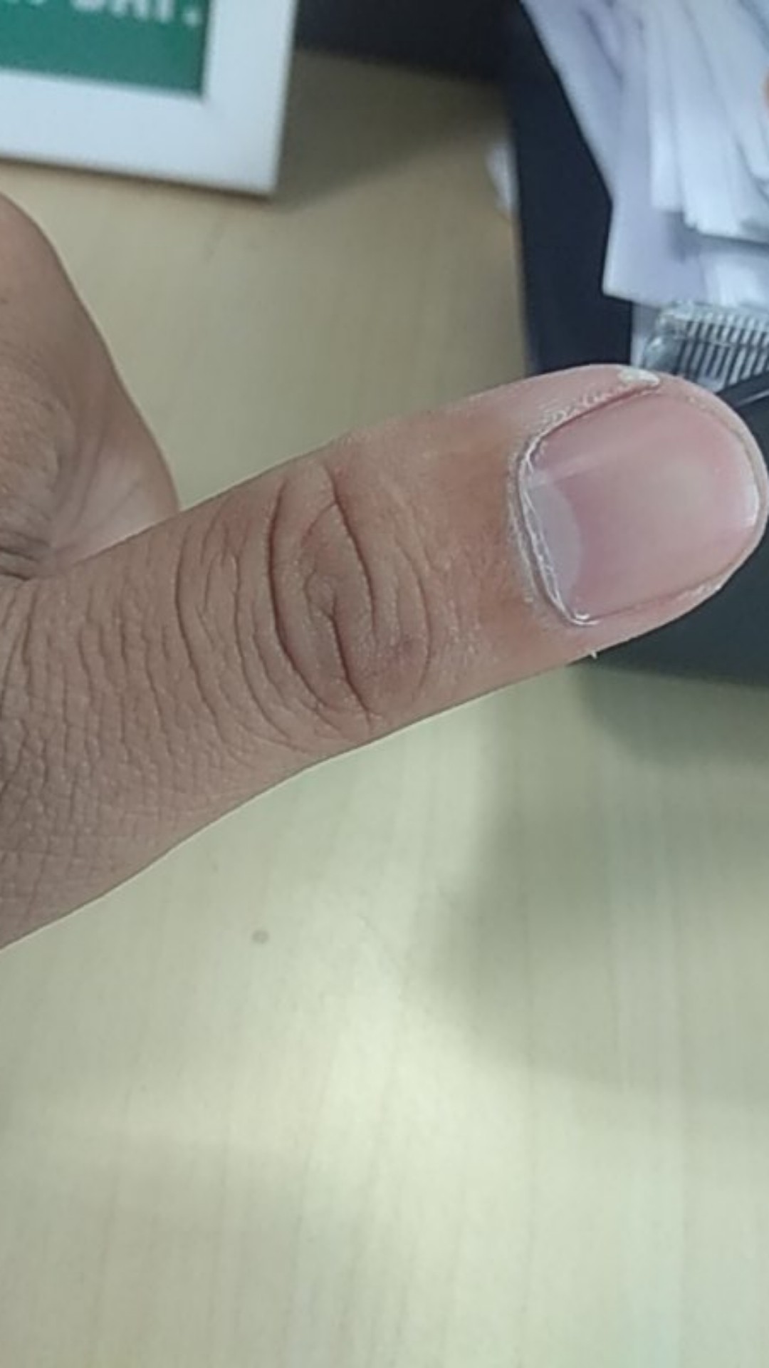 Plastik Mika Spp 15.5 X 22 / Plastik Deposito / Kantong Mika Dengan Penutup / Pak Isi 100