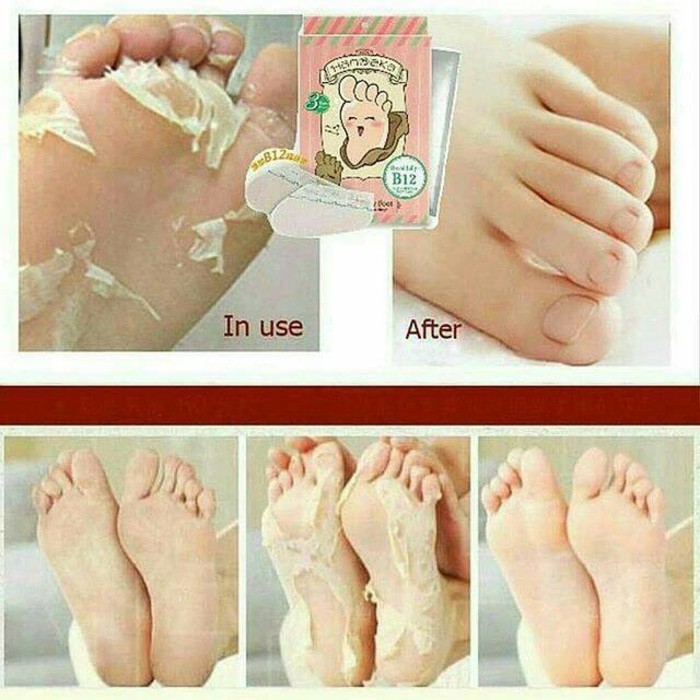 PROMO - READY STOCK HANAKA BABY FOOT KULIT KAKI TUMIT PECAH-PECAH PERAWATAN KAKI
