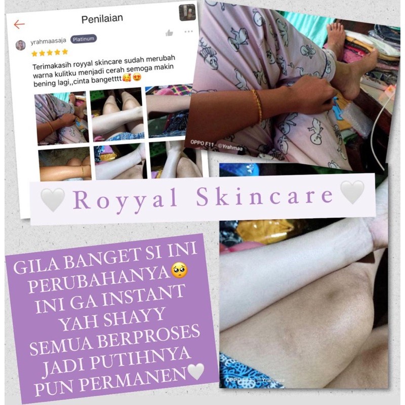 Sabun Badan Pemutih Permanen / White Diary Gluta Body Soap / Putih Instan / Royyal Body Wash Whitening