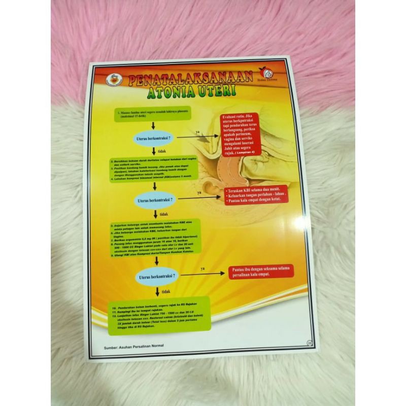 

(22) POSTER PENATALAKSANA PADA ATONIA UTERI