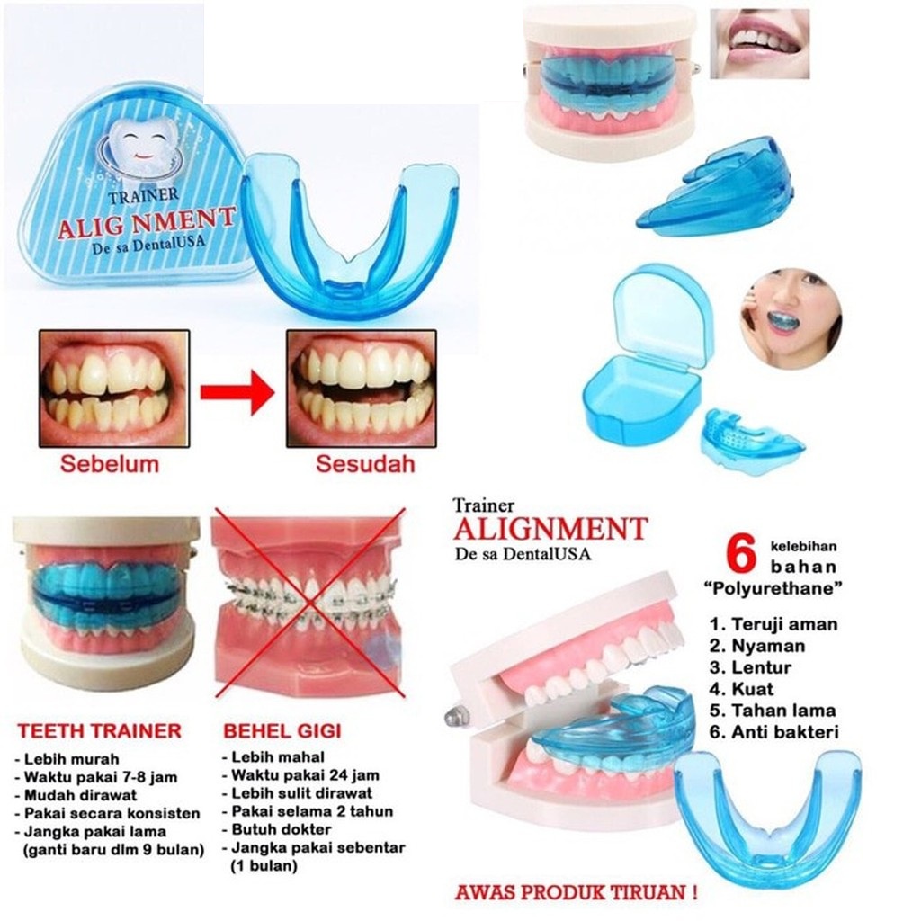 BEAUTY JAYA - NEW IMPORT -Perapih Gigi Original 100% Made In USA Teeth Trainer Alignment - Behel Gigi Lepas Pasang