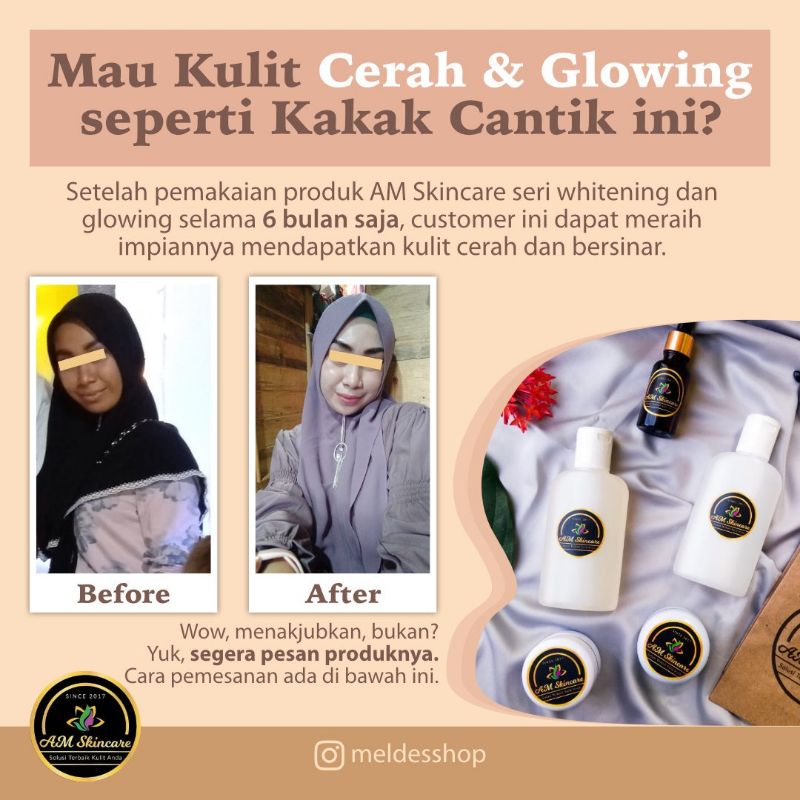 PAKET KULIT NORMAL BY AMSKINCARE | PUTIH GLOWING