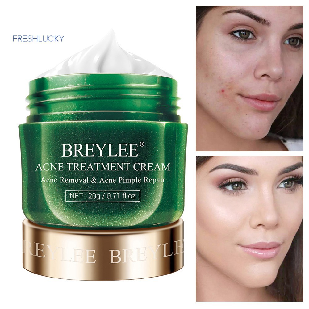 BREYLEE Acne Cream Obat Jerawat Krim Remover Acne Moisturizer Whitening Skincare 20g GIRLSNEED77