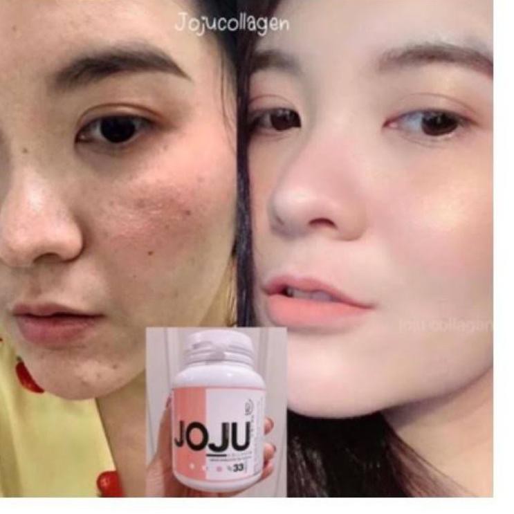 JOJU COLLAGEN COLAGEN SUPLEMEN PEMUTIH KULIT TUBUH PATEN AMPUH S03P