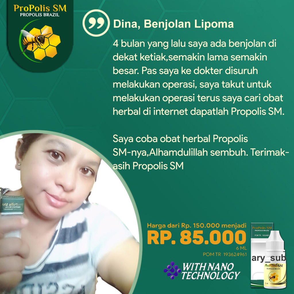 Obat Penghilang Benjolan Ditubuh, Lipoma, Uci, Tiroid, Benjolan Abnormal, Benjolan Ditangan, Benjolan Dikaki, Benjolan Di Punggung, Benjolan Dijidat, Benjolan Dikaki, Kelenjar Getah Bening – ProPolis SM Brazil 100% Original BPOM