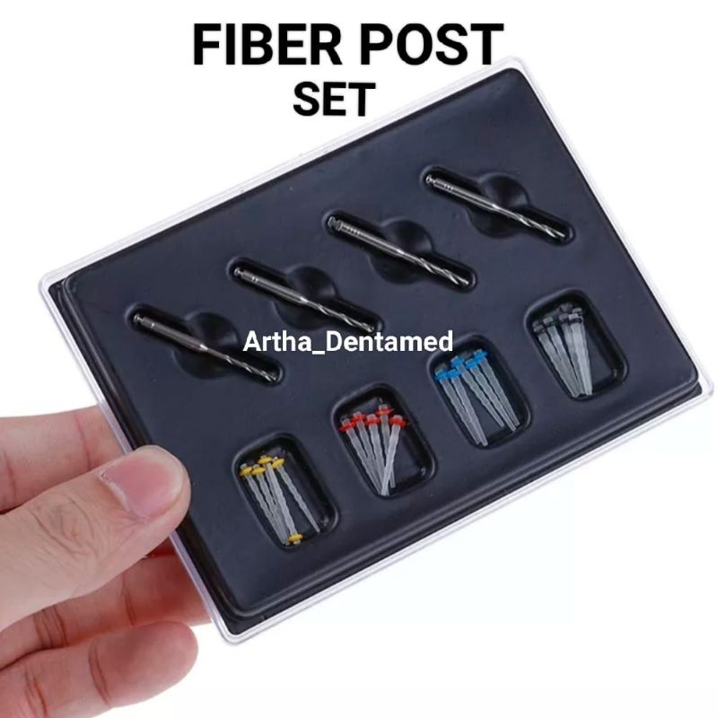 FIBER POST