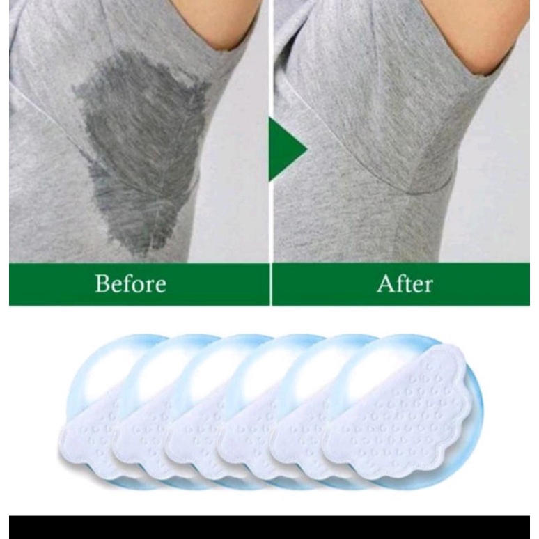 PENYERAP KERINGAT KETIAK ARMPIT UNDERARM PAD SOLUSI BURKET AREA KETEK BAU ANTI BASAH