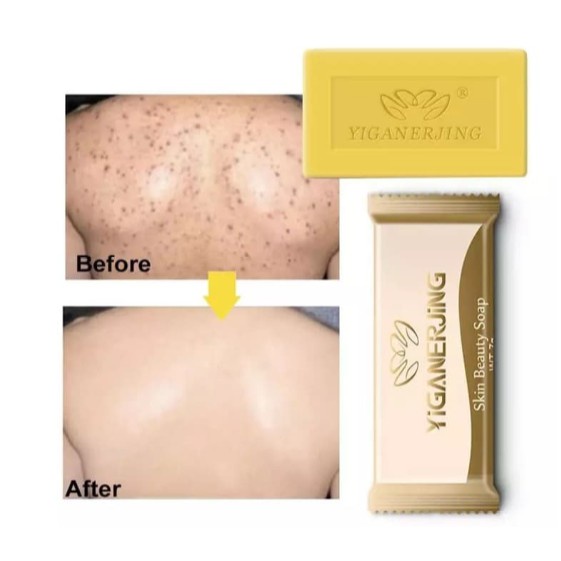 Yiganerjing 100% asli obat gatal dermatitis eksim psoriasis anti jamur bakteri gatel alergi salep-2