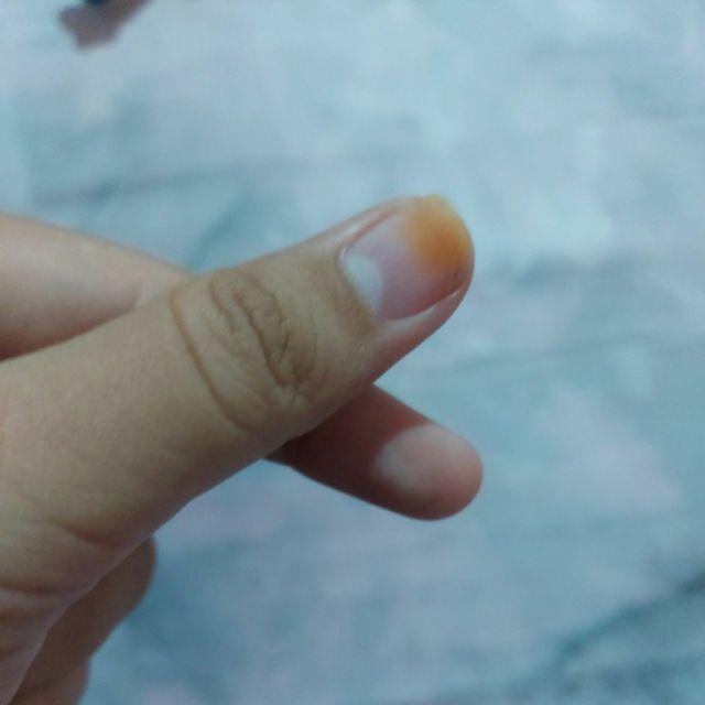 Sendok + Garpu