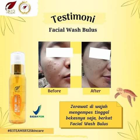 Facial Wash SR12 | Facial Wash Bulus &amp; Facial Wash Honey | Sabun Wajah SR12 Skincare
