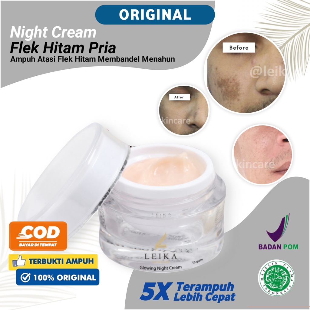 Flek Hitam Di Wajah Membandel Flek Hitam Ampuh Cepat BPOM Permanen Krim Plek Hitam Pria Terampuh Kri