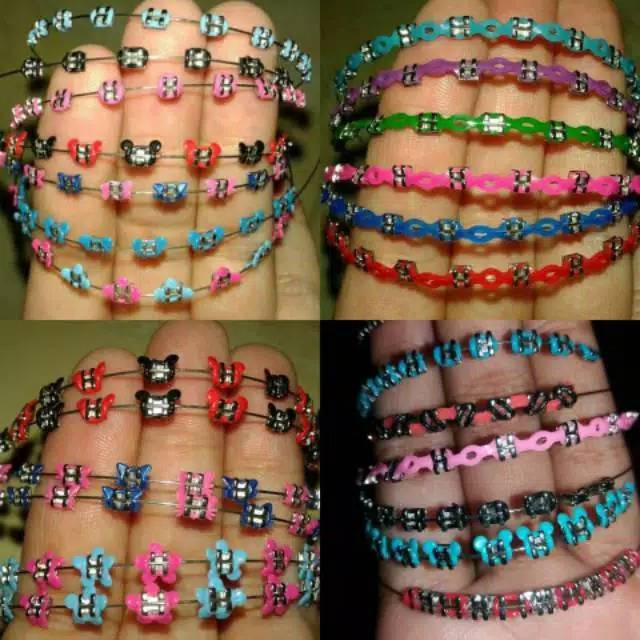 Kawat Behel gigi lepas pasang motif cantik