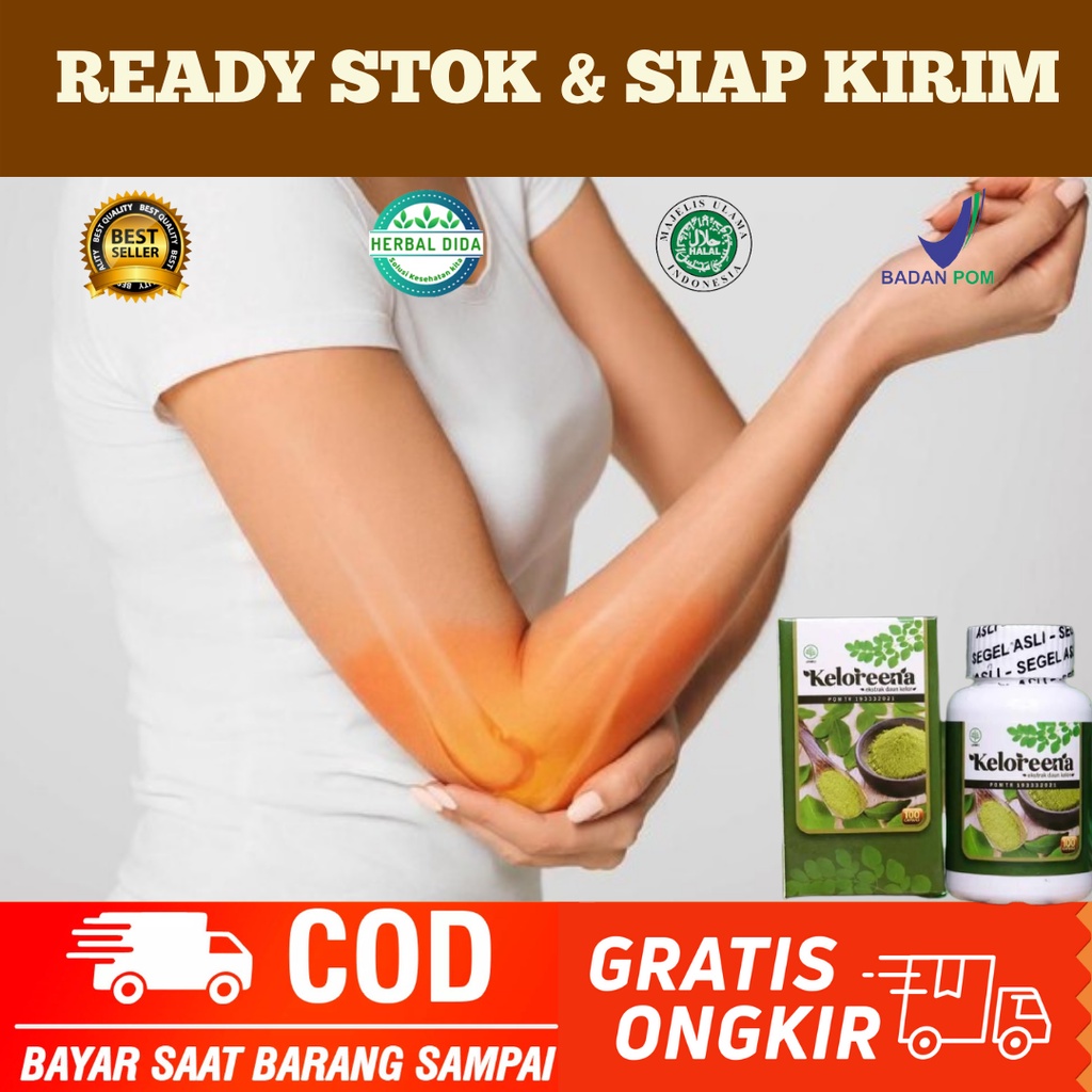 Obat Atasi Cidera Otot Siku, Obat Nyeri Tulang Sikut, Obat Sakit Sikut, Obat Herbal Nyeri Tulang Sik