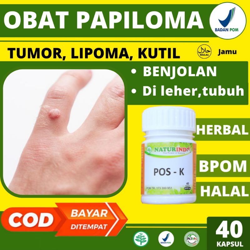 Obat Papiloma Penghilang Papiloma di Leher Wajah Kutil Benjolan Pada Tubuh