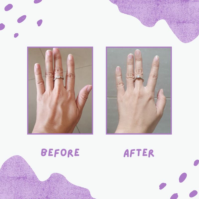 Sabun Glutathione + niacinamide VIENKA