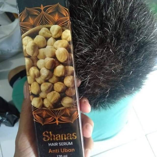 SERUM UNTUK MENGATASI UBAN