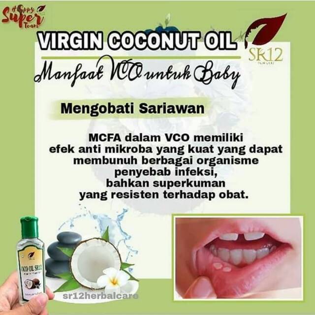 Obat sariawan paling ampuh..