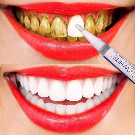 Pemutih Gigi Instant Pen DAZZLING WHITE Murah Ori Teeth Whitening Gel