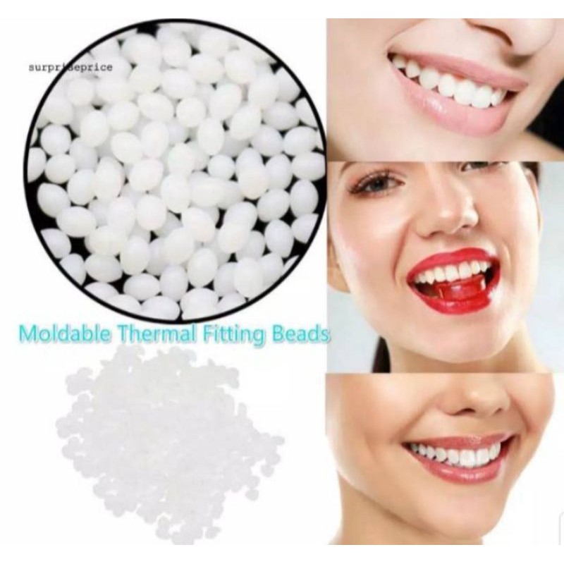 gel penambal gigi ompong/retak/renggang