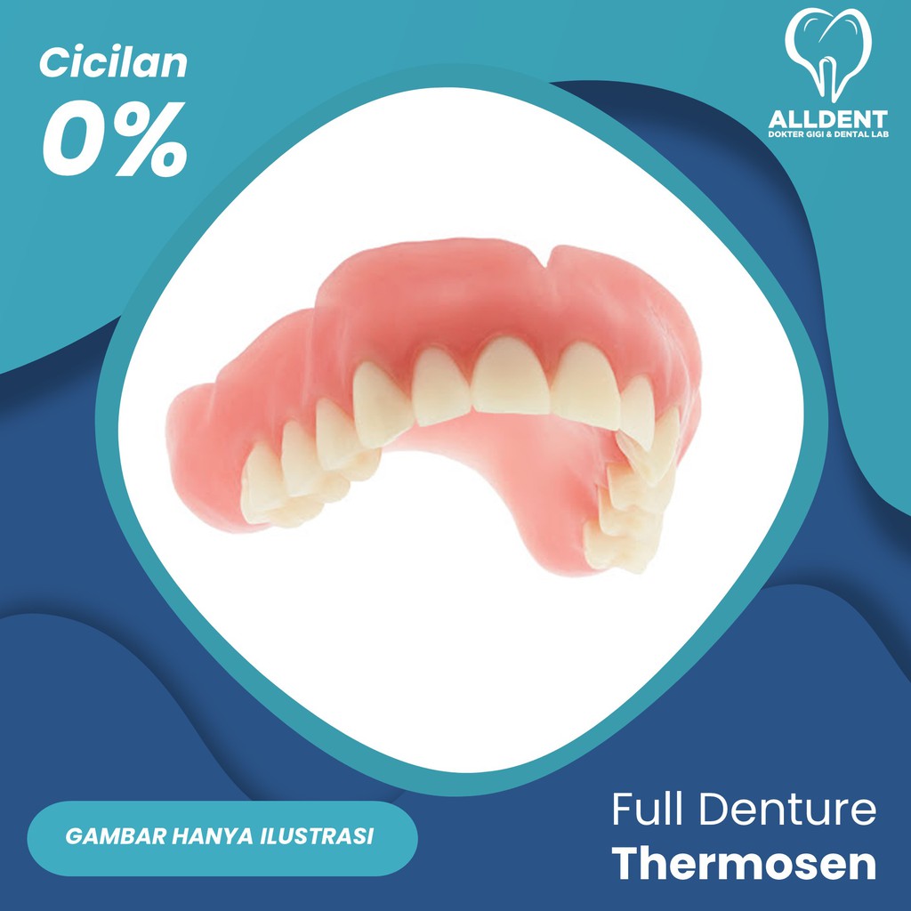 Gigi Palsu Lepasan 2 Rahang - Full Denture Thermosen