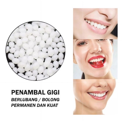 BEYOND - [PAKET 50 BUTIR] Gigi Palsu / Temptooth Lem Tambal Gigi Ompong Patah dan Berlubang / Temporary Tooth