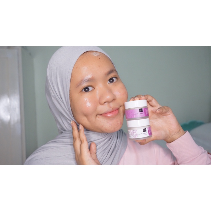 [COD] Paket Acne Cream Day &amp; Night Scarlett 20gr AMPUH Melawan Bakteri Jerawat Wajah dalam 2 minggu