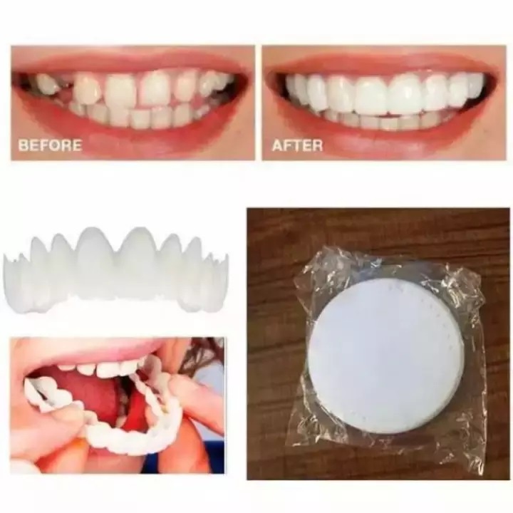 DBI - SNAP ON SMILE SEPASANG GIGI PALSU SILICON 1 SET ATAS BAWAH