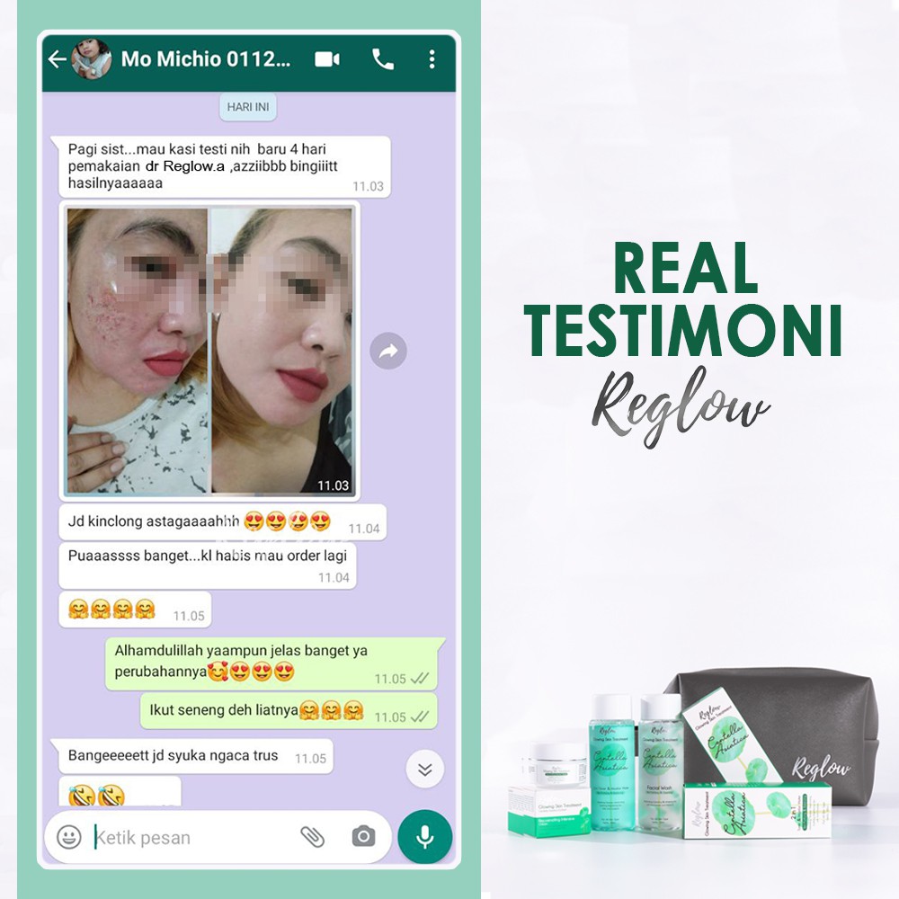 Paket Cream Dan Toner & MicellarWater REGLOW Utk menghilangkan Flek Jerawat Kerutan-7