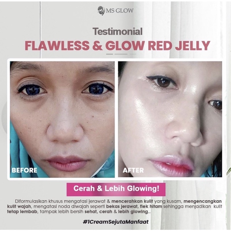 RED JELLY MSGLOW WAJAH GLOWING TERLARIS