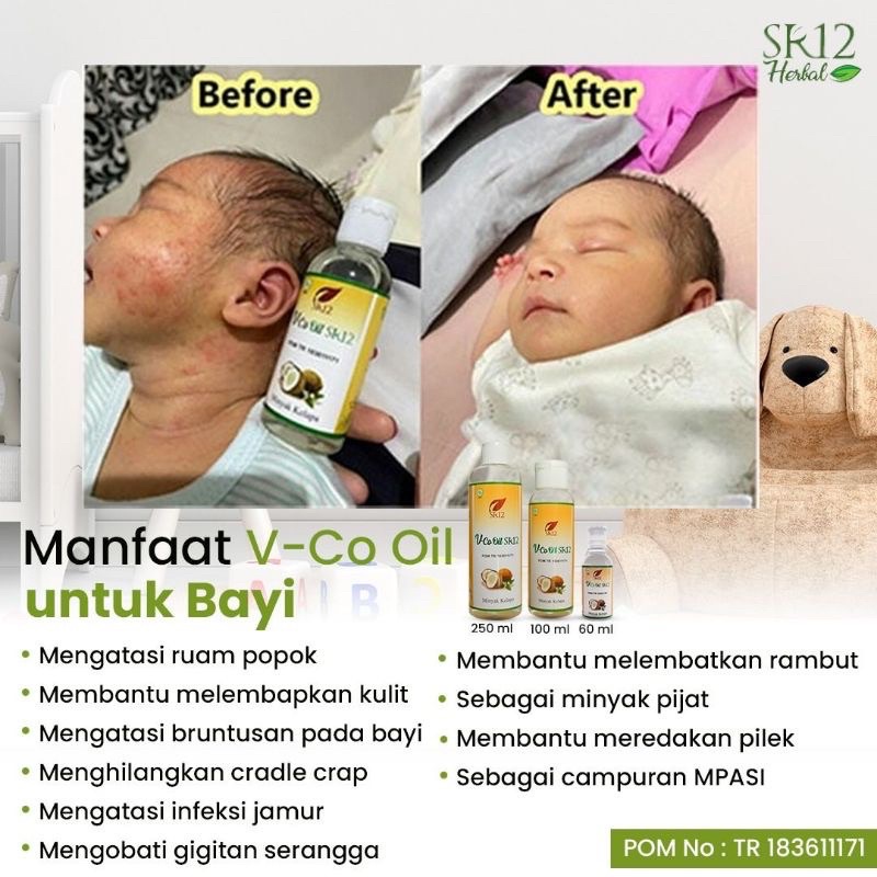 

obat gatal bayi/VCO / Virgin Coconut Oil/Minyak kelapa asli BPOM