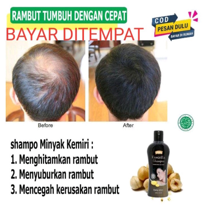 [BISA COD] Shampoo Kemiri ku 100% ORIGINAL