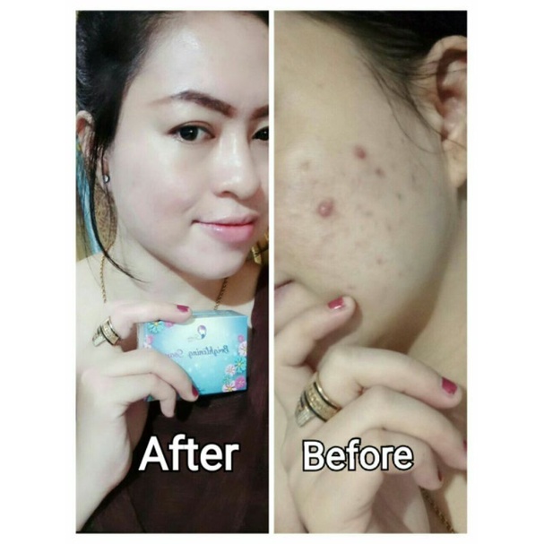 sabun kedas beauty, Pemutih Wajah, Badan ,Flek ,Ketiak ,Pria, Original-5