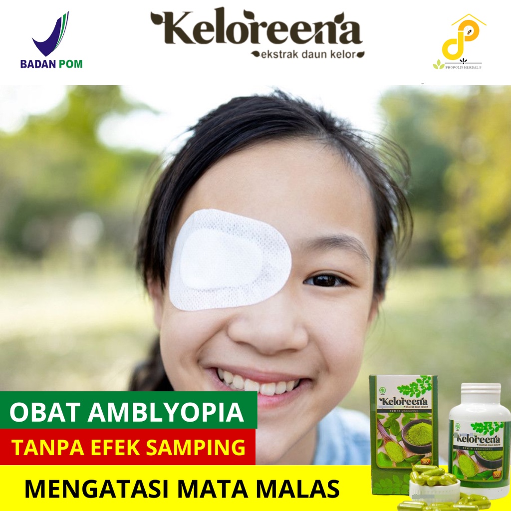 Mata malas atau amblyopia Obat Mata Lemah Pandangan Redup, Mengobati Mata minus 1,2,3 MATA MALAS SEB