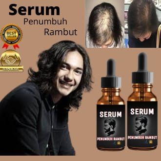 serum penumbuh rambut/serum penumbuh rambut botak super cepat/serum penumbuh rambut botak/serum penumbuh rambut wanita/serum penumbuh rambut rontok/serum penumbuh rambut pria/serum penumbuh rambut super cepat