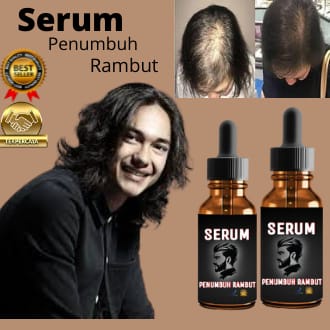 serum penumbuh rambut/serum penumbuh rambut botak super cepat/serum penumbuh rambut botak/serum penu