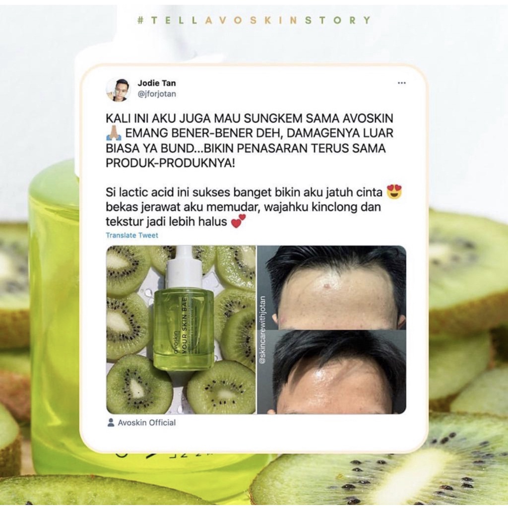 Avoskin Your Skin Bae Lactic Acid 10% + Kiwi Fruit 5% + Niacinamide 2,5% High Dose Serum 30ml