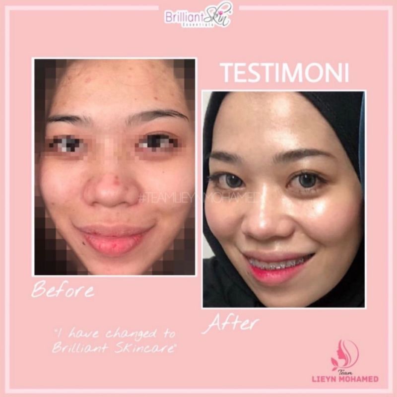 [ BISA COD ] BRILIANT REJUVENATING KEMASAN TERBARU ORIGINAL
