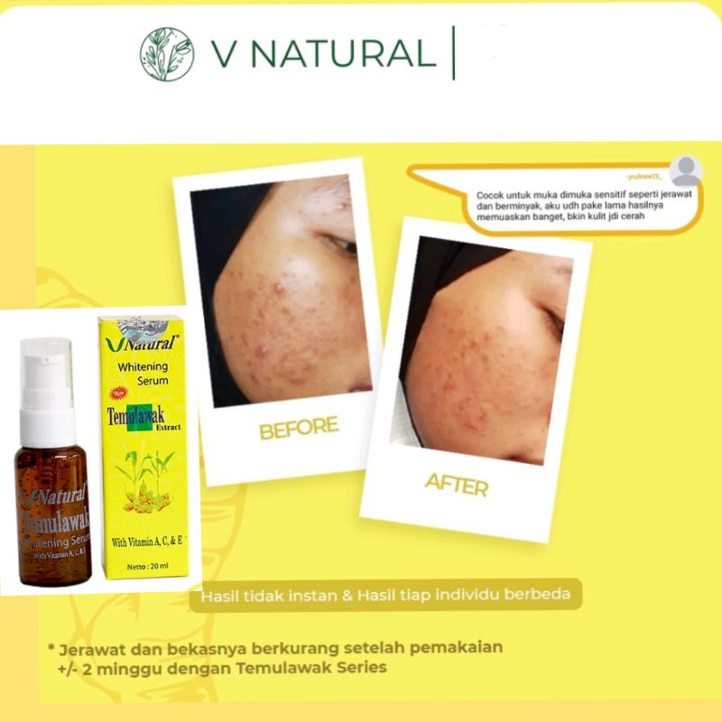 VNATURAL TEMULAWAK WHITENING SERUM