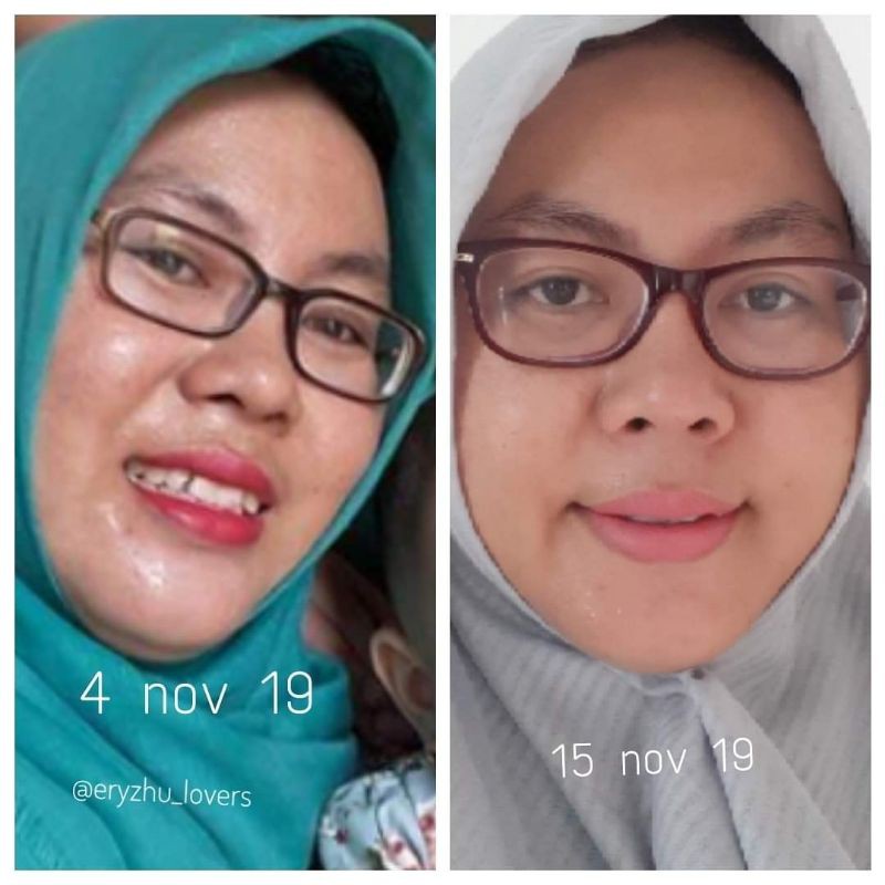 ERYZHU - ANTI AGING | DISKON 11% | MENUTRISI | SEHAT