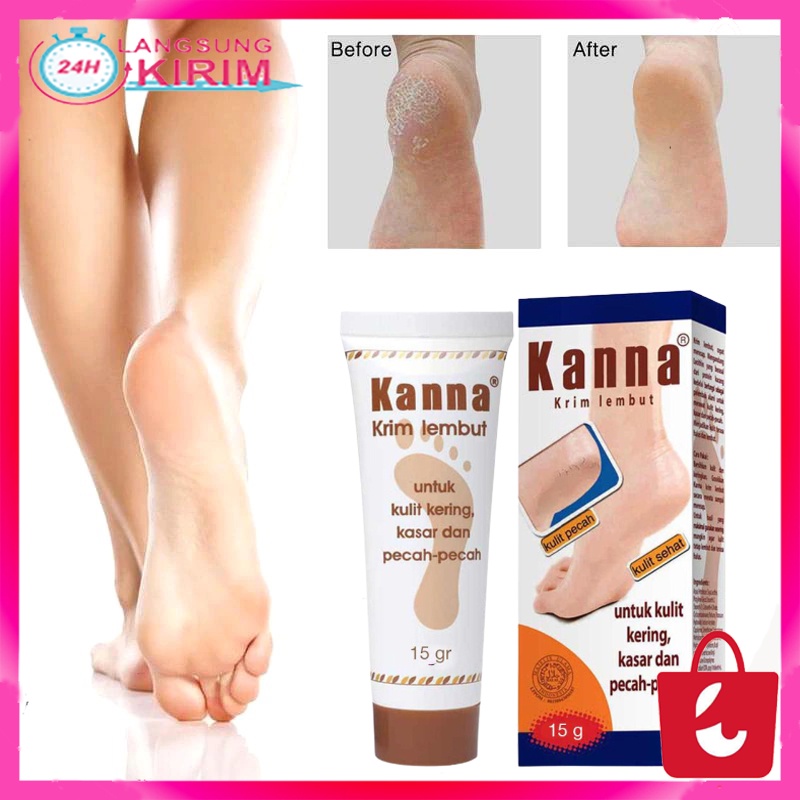 [BISA COD] Kanna Krim Kaki Krim Lembut Menagatasi Tumit Pecah Kaki Kasar Kulit Pecah