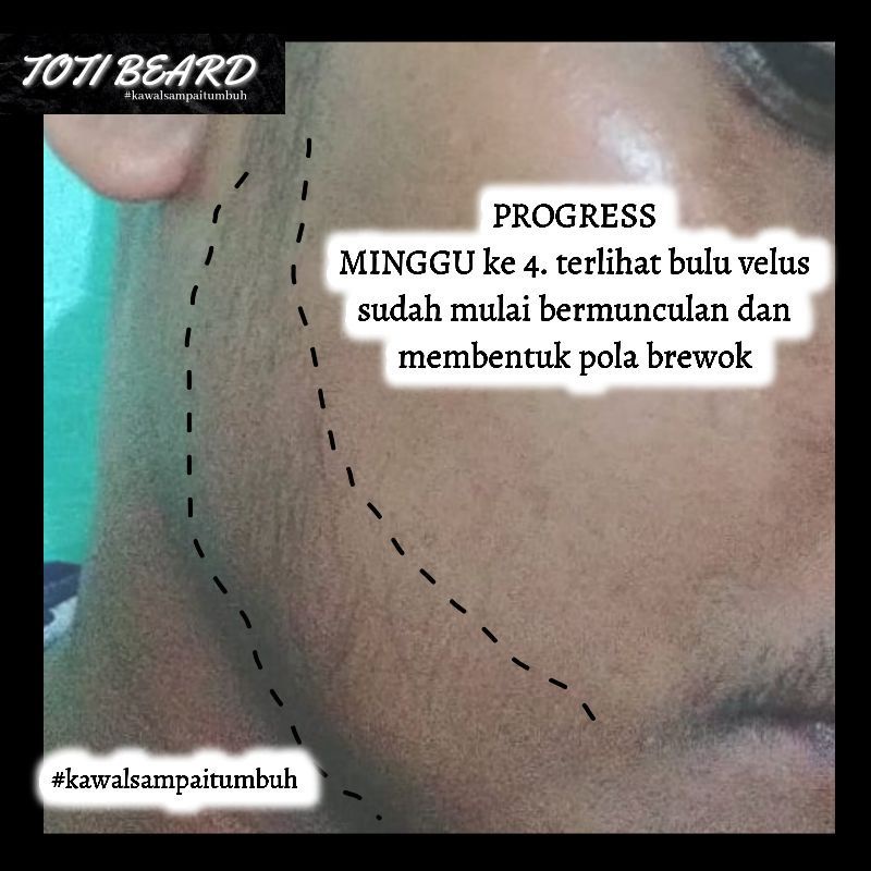 SERUM KHUSUS PENUMBUH BULU BREWOK TANPA GEN #TOTIBEARDSERUM