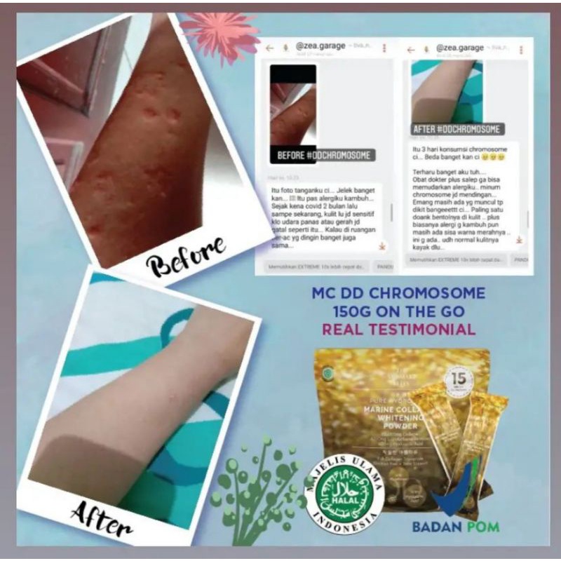 Marine Collagen DD Chromosome Extreme Whitening Termurah