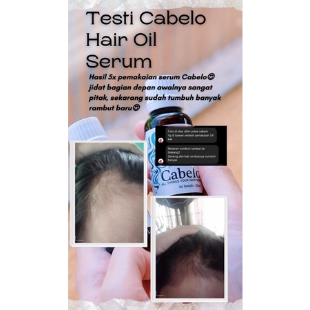 Serum rambut - Hair serum - Anti rontok || Serum rambut Cabelo penumbuh rambut ampuh-6