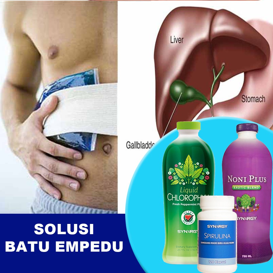Paket Obat Herbal Batu Empedu & Meningkatkan Kekebalan Tubuh