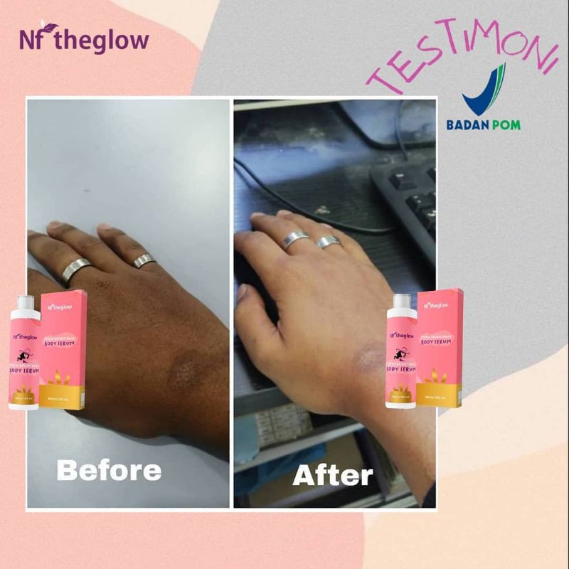 Fyskin Brightening Body Serum/nftheglow/pemutih badan/bodyserum viral tiktok